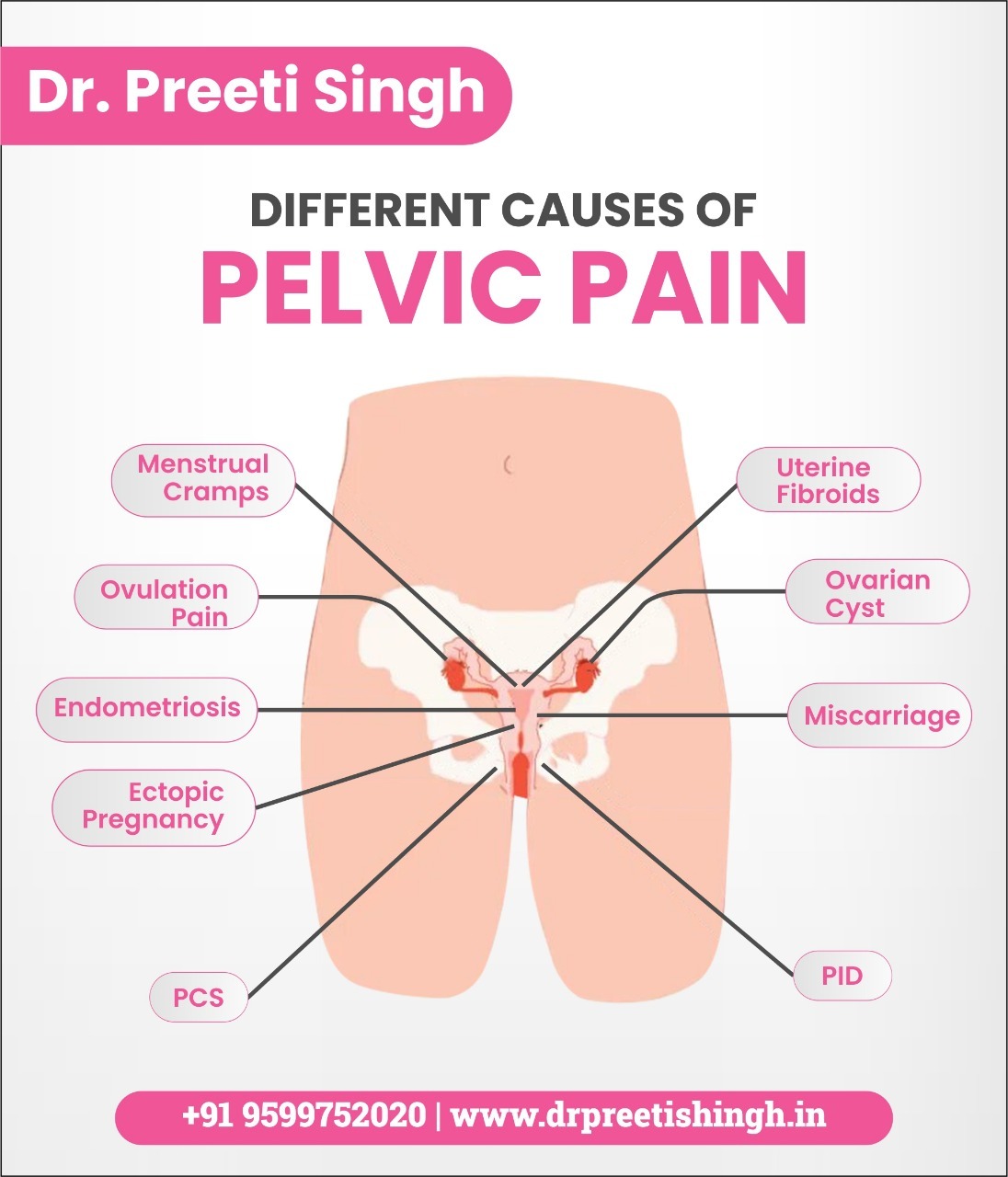 different causes of pelvic pain